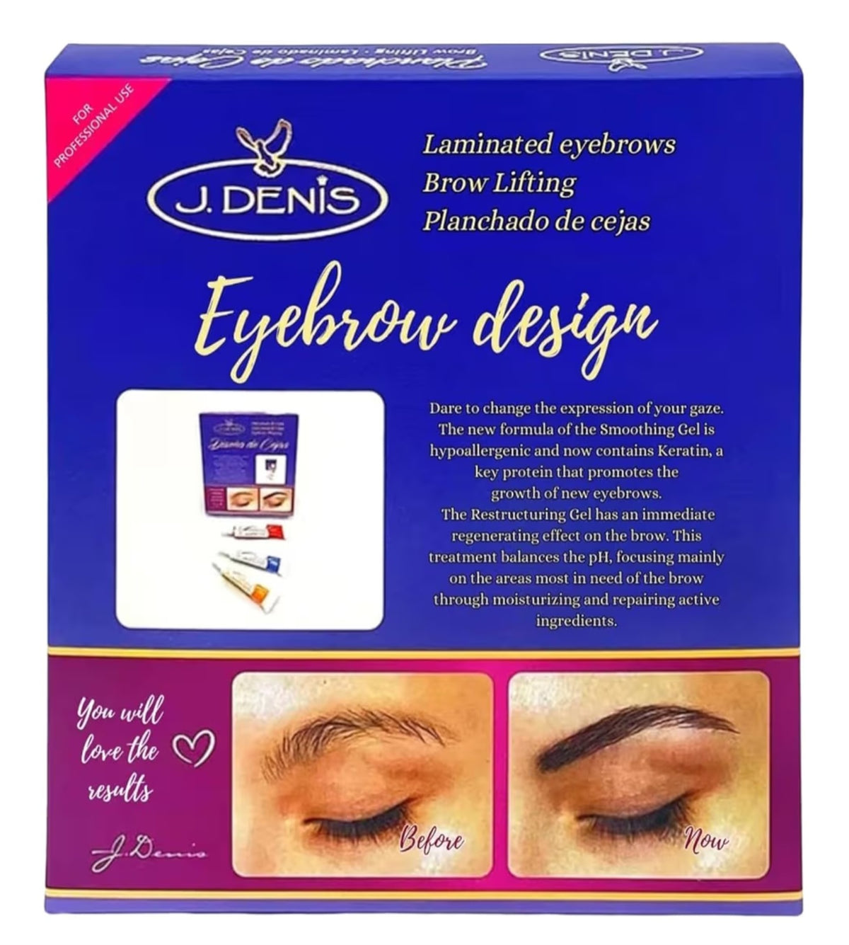 Kit Laminado